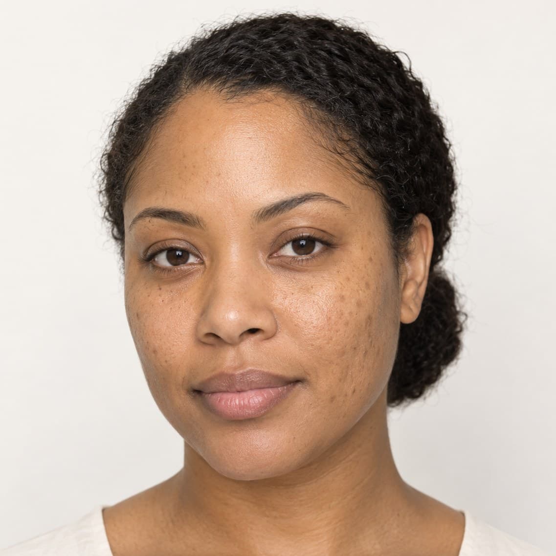 Illustration of skin with sun spots and uneven tone before CoolPeel treatment (AI-generated, not a patient)